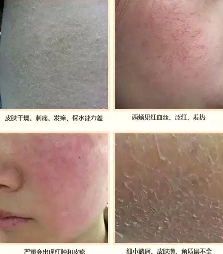 外油内干:油干并存怎么办