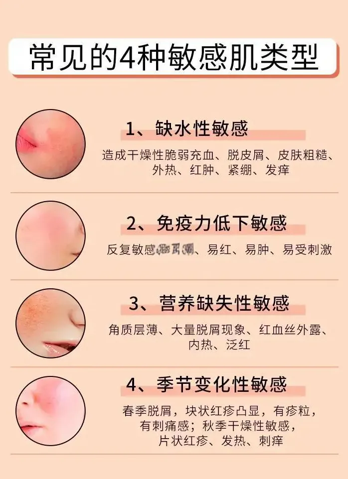 分区问题:额头闭口与下巴痘示意图