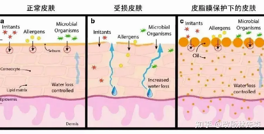 护肤问题肌护理配图4